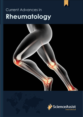 Current Advances in Rheumatology