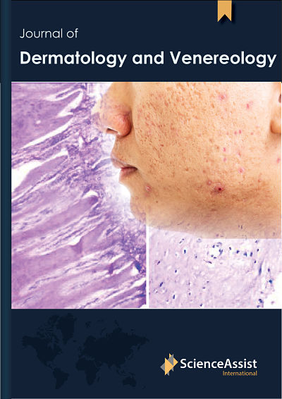 Journal of Dermatology and Venereology